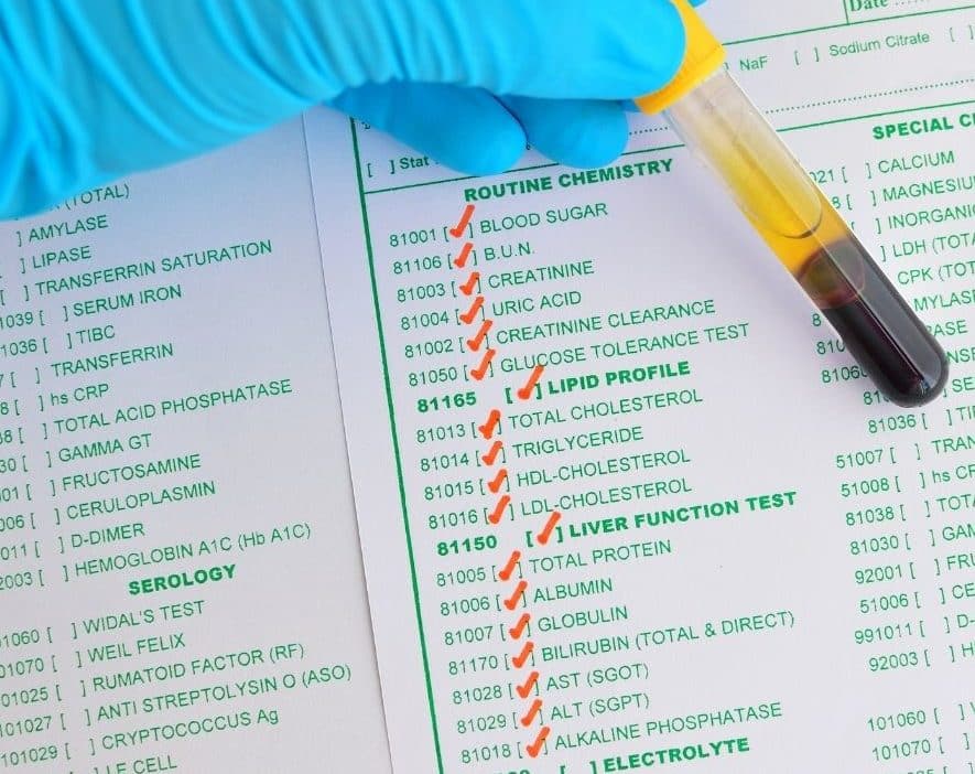 cual es la diferencia entre los resultados de la quimica sanguinea de 27 y 35 elementos