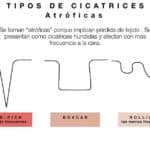 aprende la diferencia entre laser ablativo y no ablativo explicacion sencilla y practica