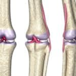 cuales son las diferencias entre ligamentos y tendones explora sus caracteristicas y funciones