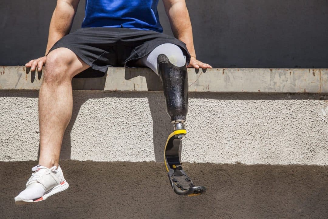 descubre la diferencia entre protesis y ortesis aprende a usar la que mas se ajuste a tus necesidades