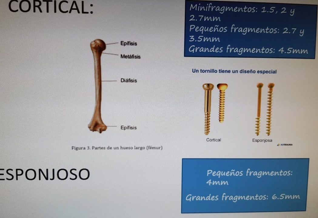 cuales son las diferencias entre un tornillo cortical y un tornillo esponjoso