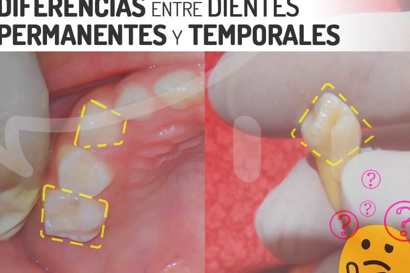 dientes primarios vs permanentes que diferencias debes conocer