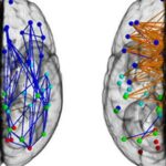 diferencias cerebrales entre hombres y mujeres estudios cientificos revelan datos reveladores