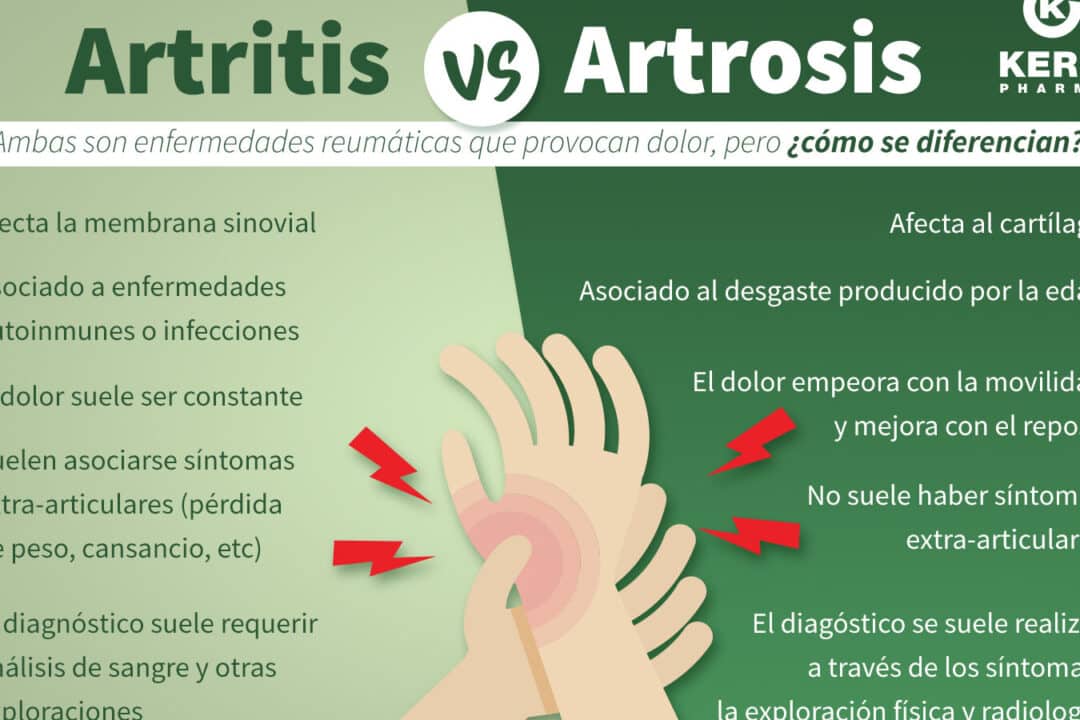 diferencias clave entre artritis y artrosis en las manos como identificar y tratar cada afeccion