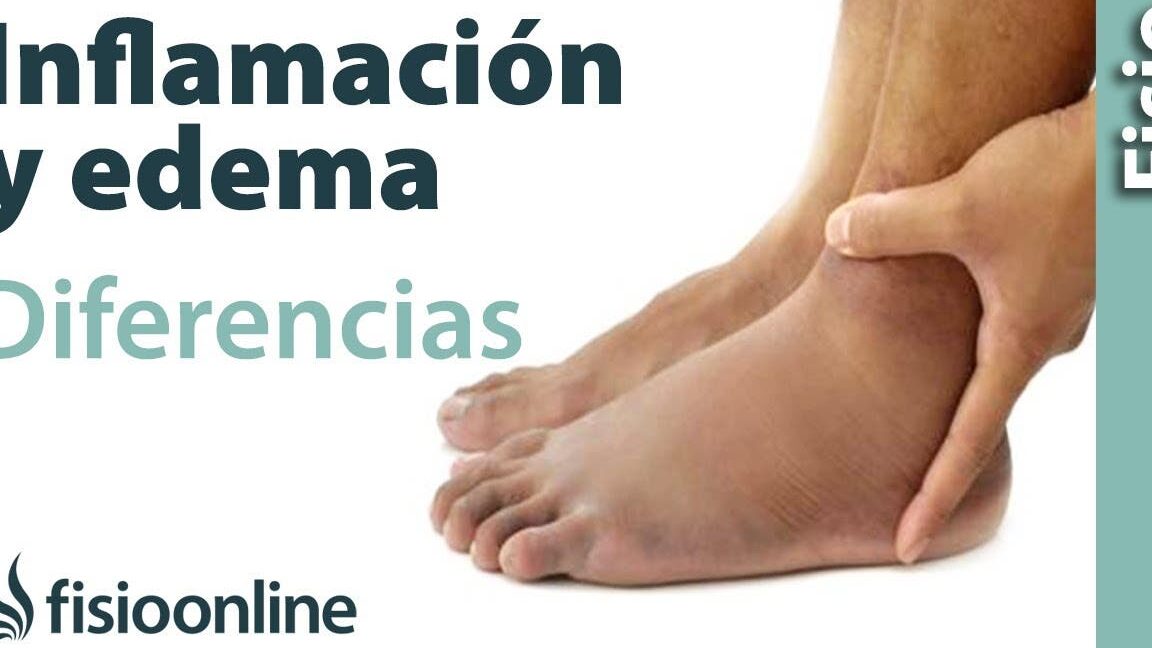 diferencias clave entre edema e inflamacion todo lo que necesitas saber