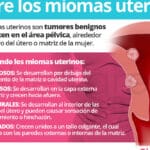 diferencias entre fibroma y mioma todo lo que debes saber para identificarlos correctamente