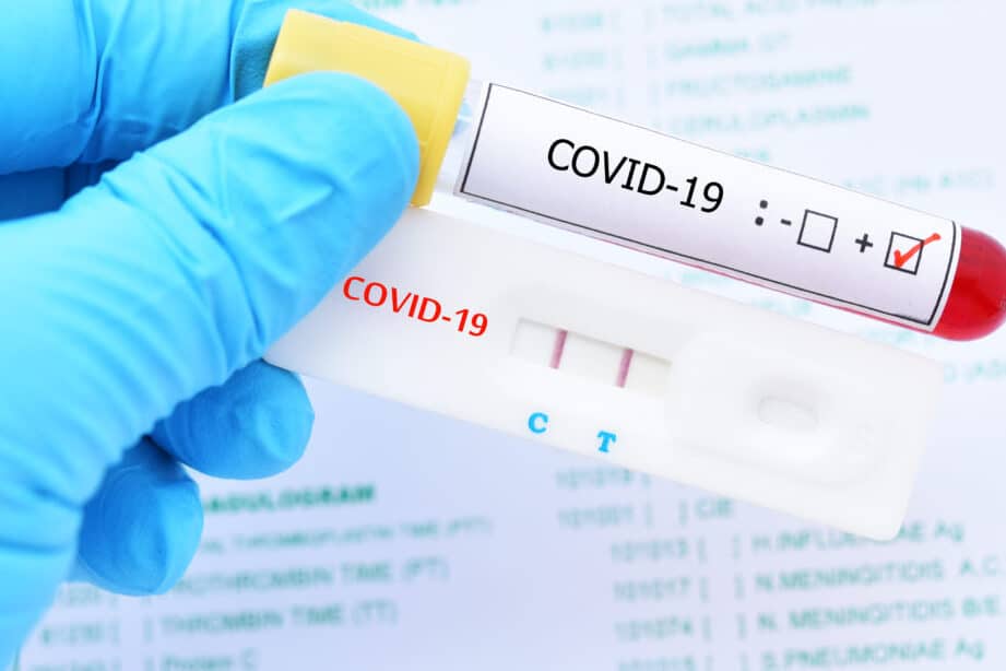 diferencias entre los test rapidos de antigenos y pcr cual es el metodo mas efectivo para detectar el covid 19