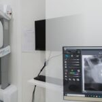 descubre las principales diferencias entre radiologia convencional y radiologia digital
