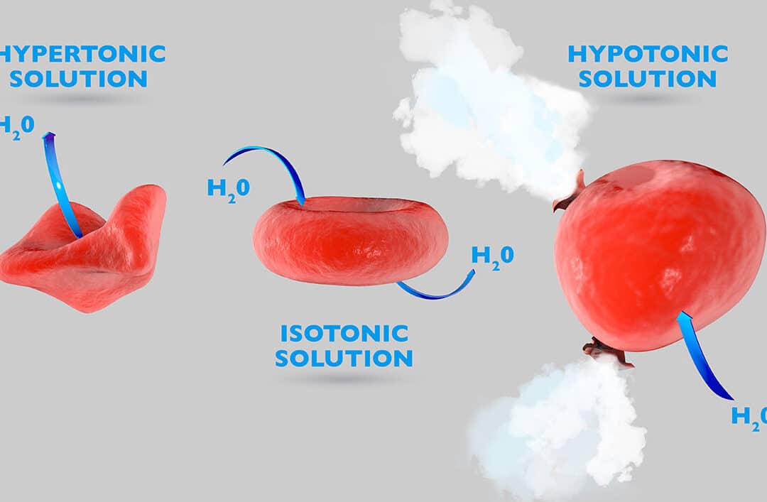 diferencias entre deshidratacion hipotonica e hipertonica todo lo que necesitas saber