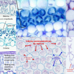 diferencias entre el aerenquima y el parenquima todo lo que necesitas saber