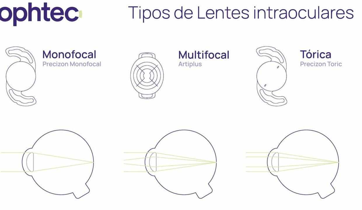 diferencias entre gafas cilindricas y toricas todo lo que necesitas saber