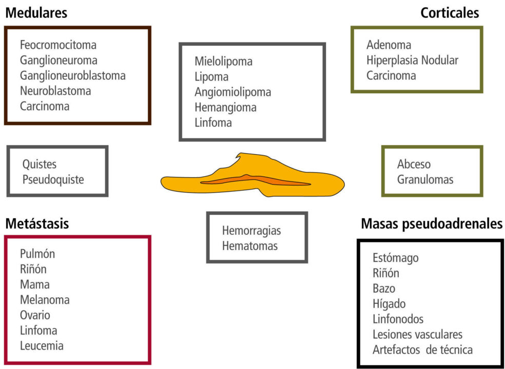 diferencias entre hiperplasia adrenocortical y adenoma descubre las caracteristicas y tratamientos