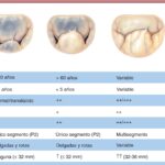 diferencias entre la valvula mitral y tricuspide que debes saber