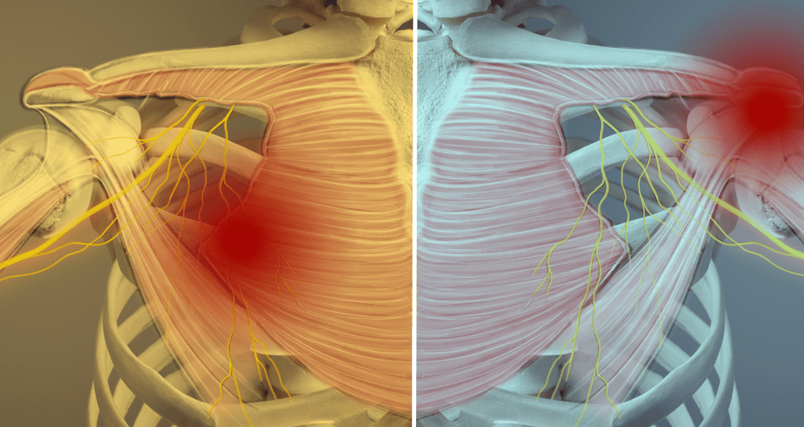 diferencias entre termoterapia y crioterapia cual es mejor para el alivio del dolor