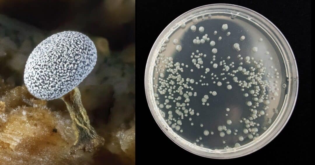 explorando las diferencias entre colonias de levaduras y bacterias cuales son las caracteristicas distintivas