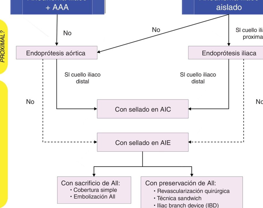 diferencias clave entre aneurisma y pseudoaneurisma descubre cual es la diferencia