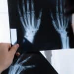 diferencias entre radiografia y tomografia guia completa para entender sus usos y beneficios