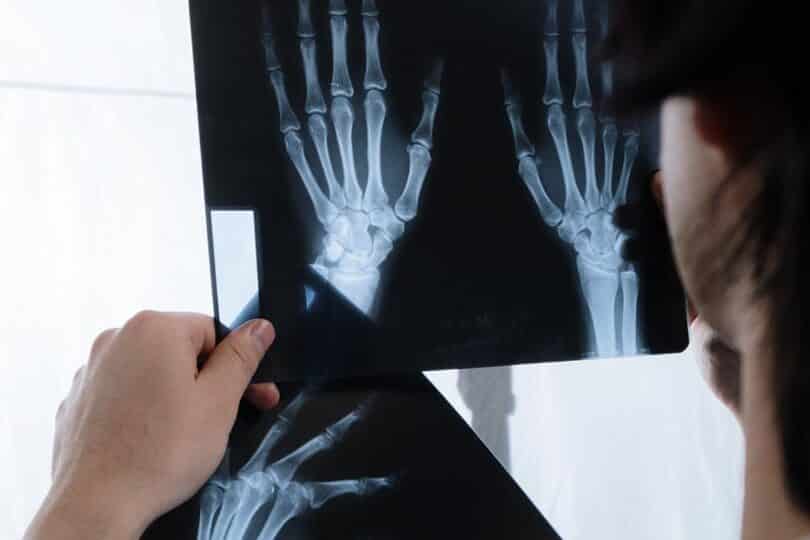 diferencias entre radiografia y tomografia guia completa para entender sus usos y beneficios