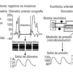 diferencias clave entre arteria elastica y muscular analisis detallado