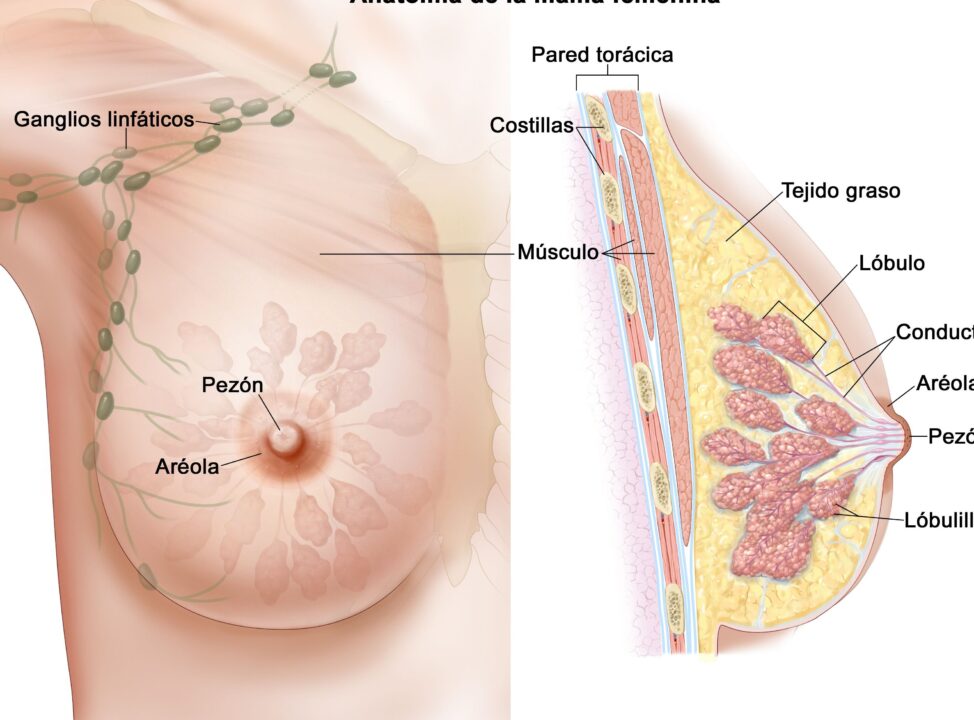 diferencias clave entre carcinoma in situ y carcinoma invasor descubre cual es la variacion mas critica en el cancer